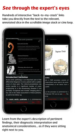 Radiology - Aortic Imaging screenshot 4