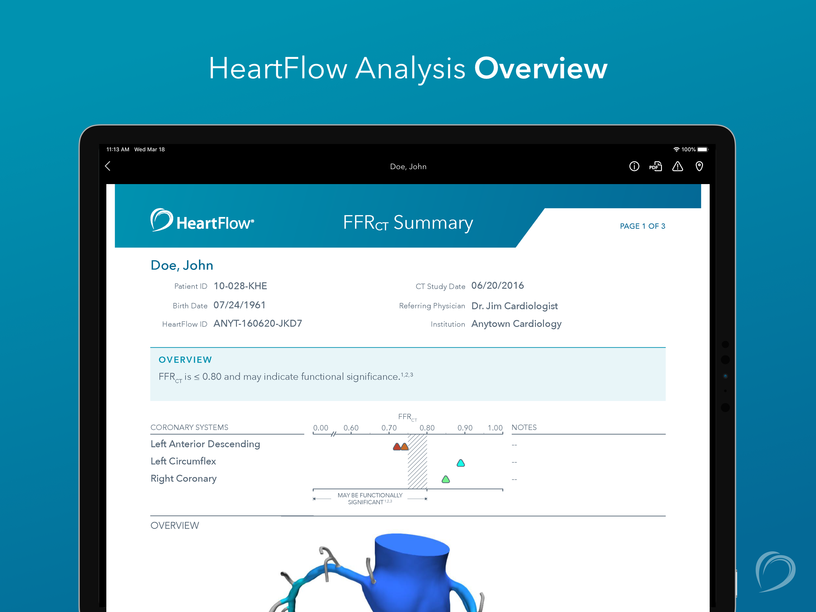 HeartFlow