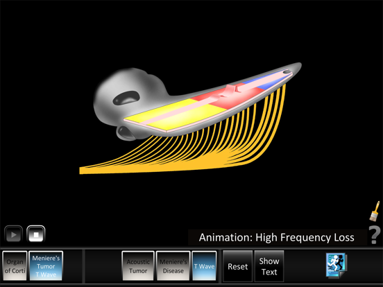 Screenshot #6 pour Ear Disorders: Inner