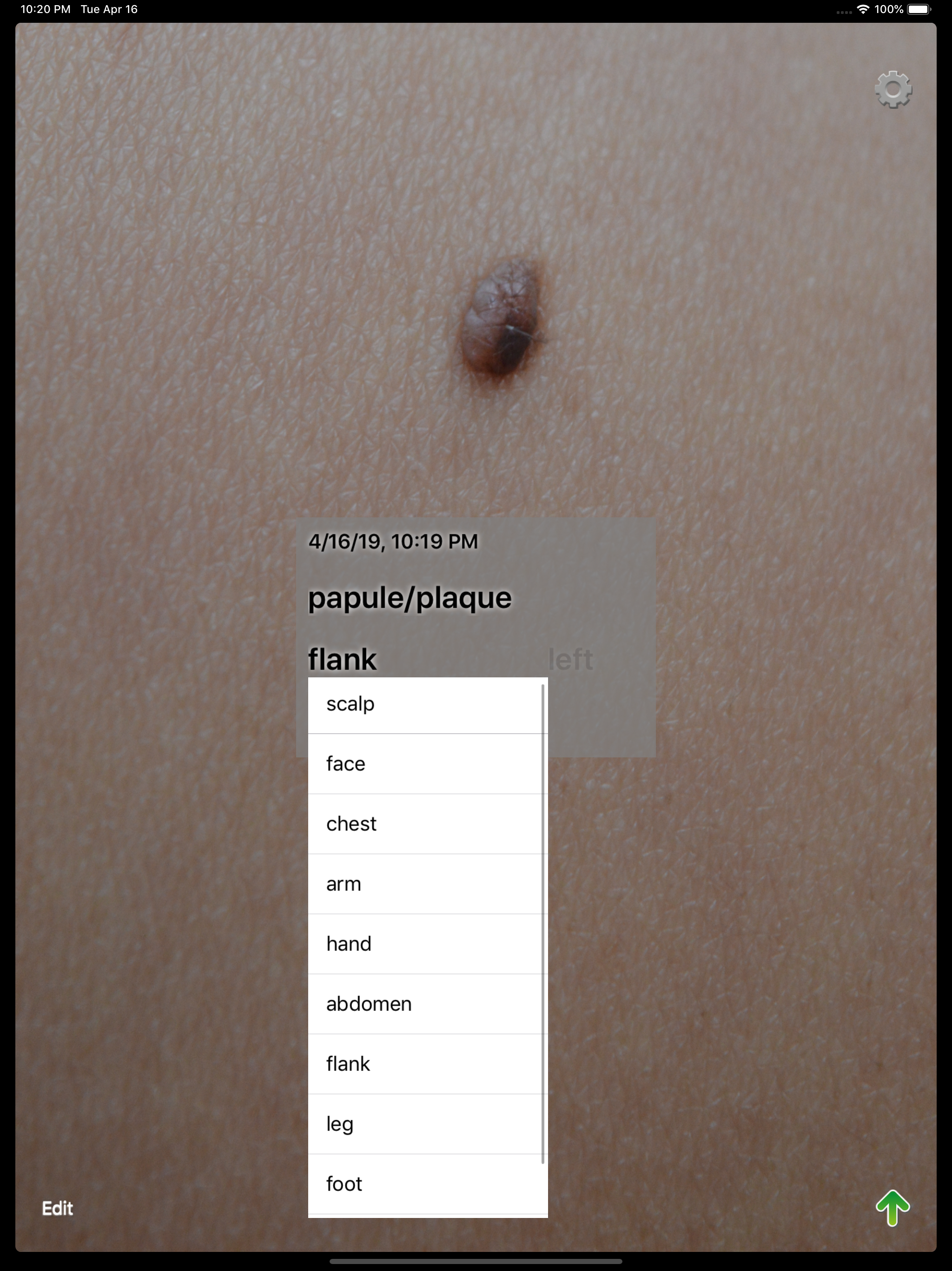 Dermcam screenshot 6