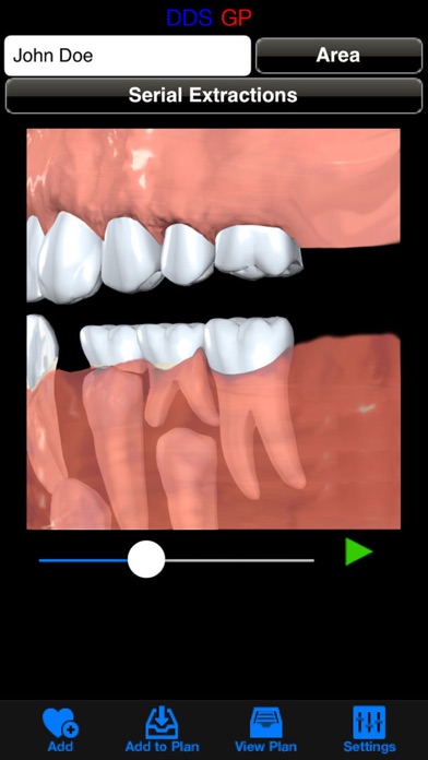 DDS GPのおすすめ画像4