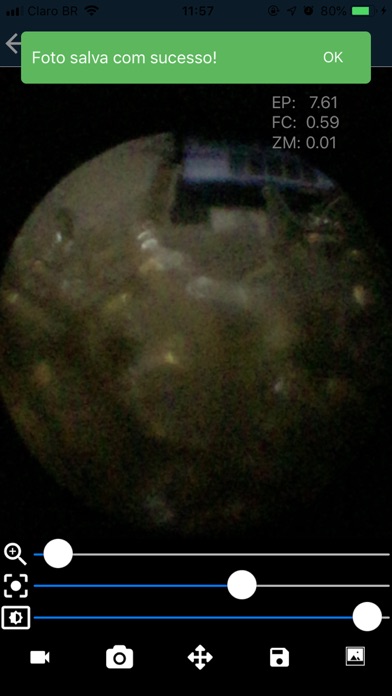 M-Scope - Mobile Endoscope Screenshot
