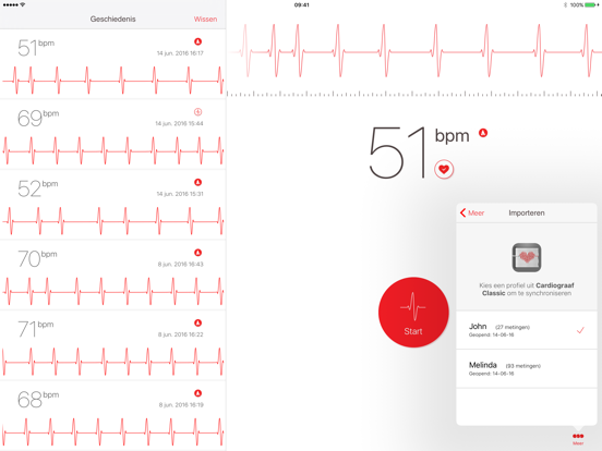 Cardiograaf iPad app afbeelding 3