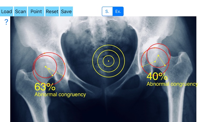 CongruenceIndexApp screenshot-0