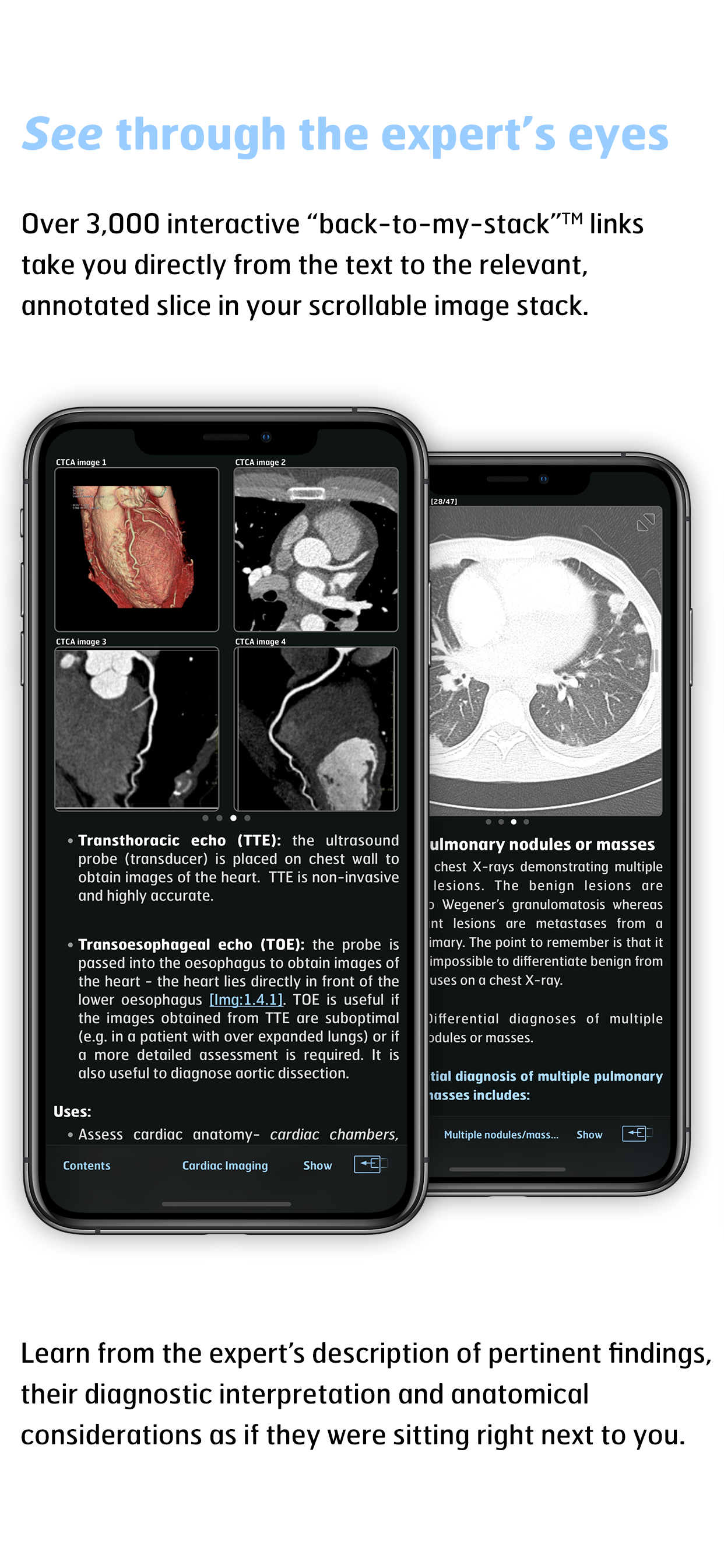 Thoracic Imaging Fundamentals screenshot 4