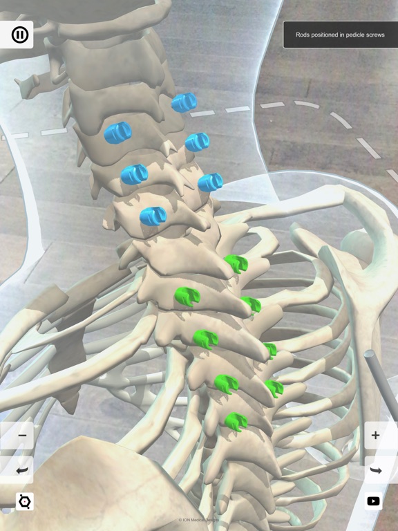 Screenshot #4 pour ION Fusion AR