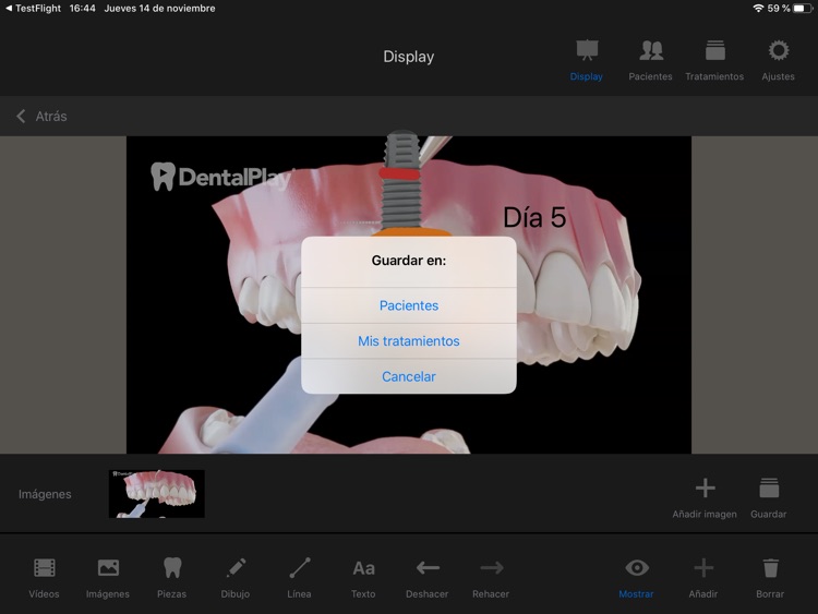 Dentool screenshot-7