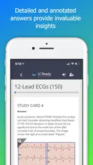 How to cancel & delete 12 lead ecg challenge 2