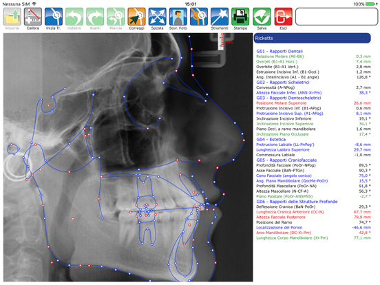 Screenshot #4 pour Delta-Dent