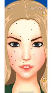 pimple popper iphone screenshot 2