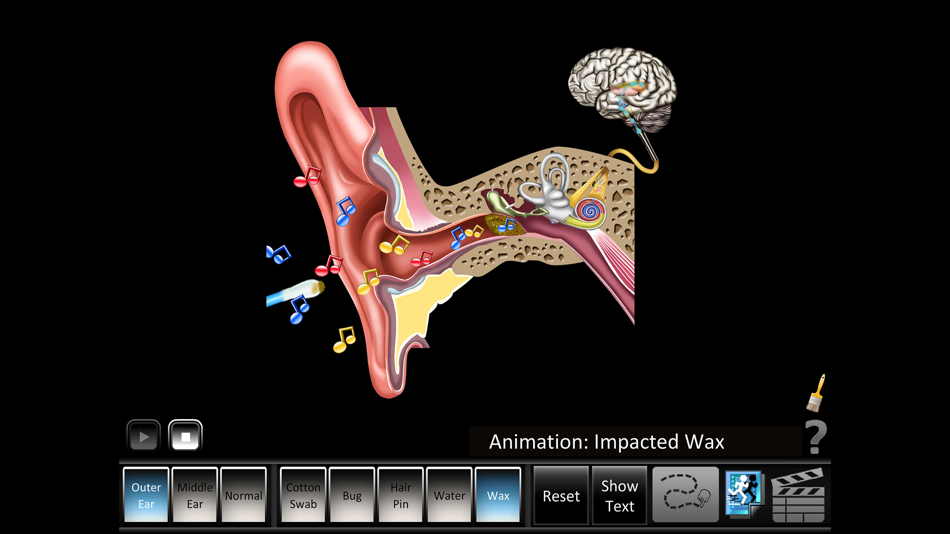 #4. Ear Disorders: Outer Middle (iOS) 由: Blue Tree Publishing, Inc.