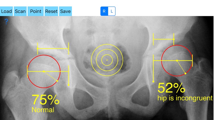 CongruityIndex screenshot-3