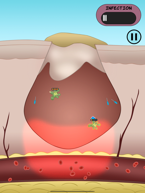 Screenshot #4 for Dermis Defense