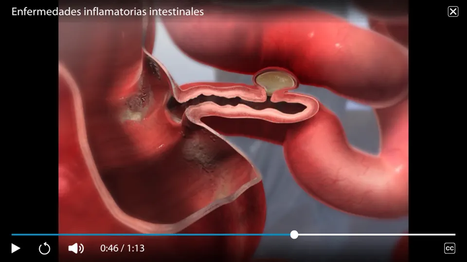 Captura de pantalla de Fisiología & Patología en iPhone 8