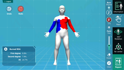 3D PED Burn Resuscitation Screenshot