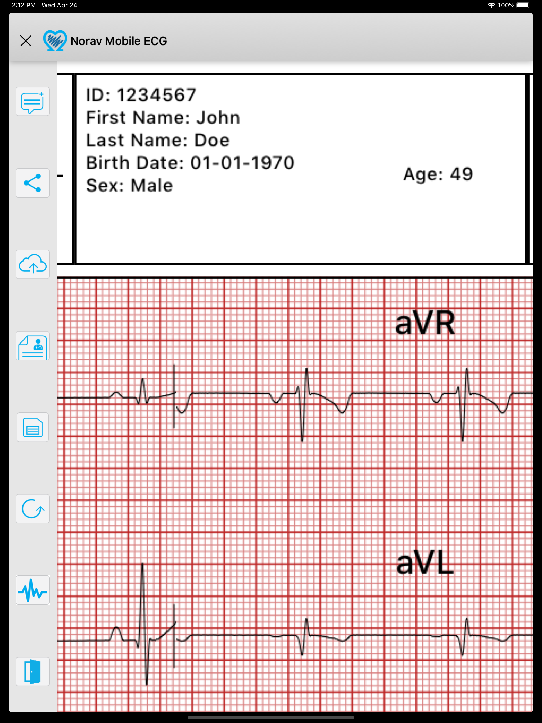 Norav Medical Mobile ECG