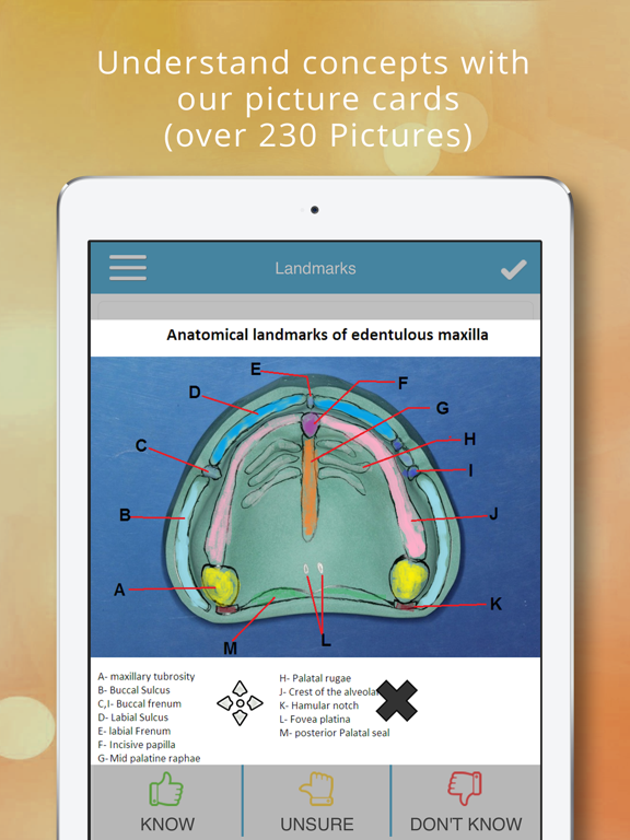 Screenshot #5 pour ADAT Prosthodontics Cram Cards