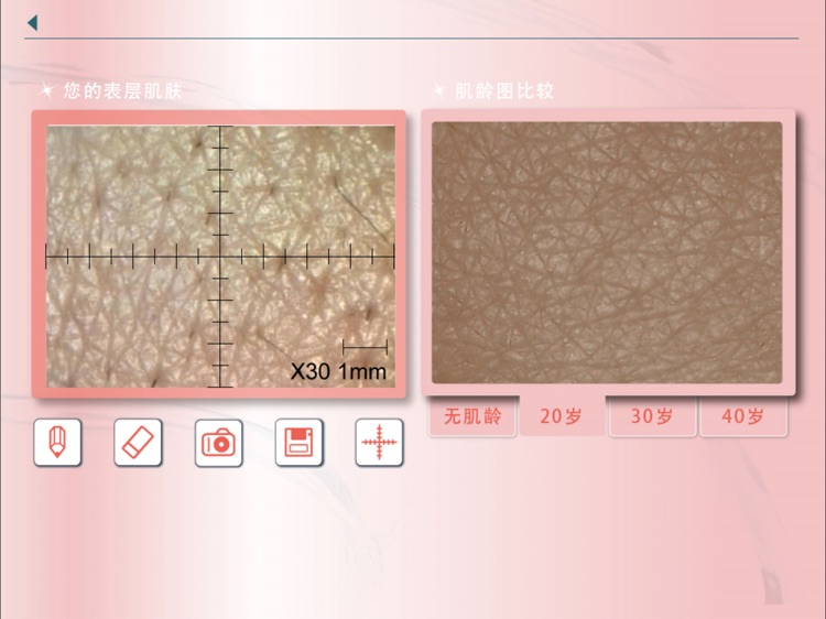Skin Analyser