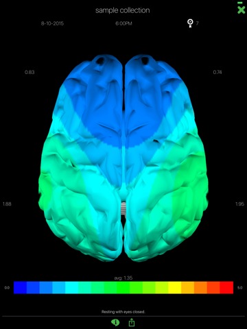 Opti Brainのおすすめ画像1