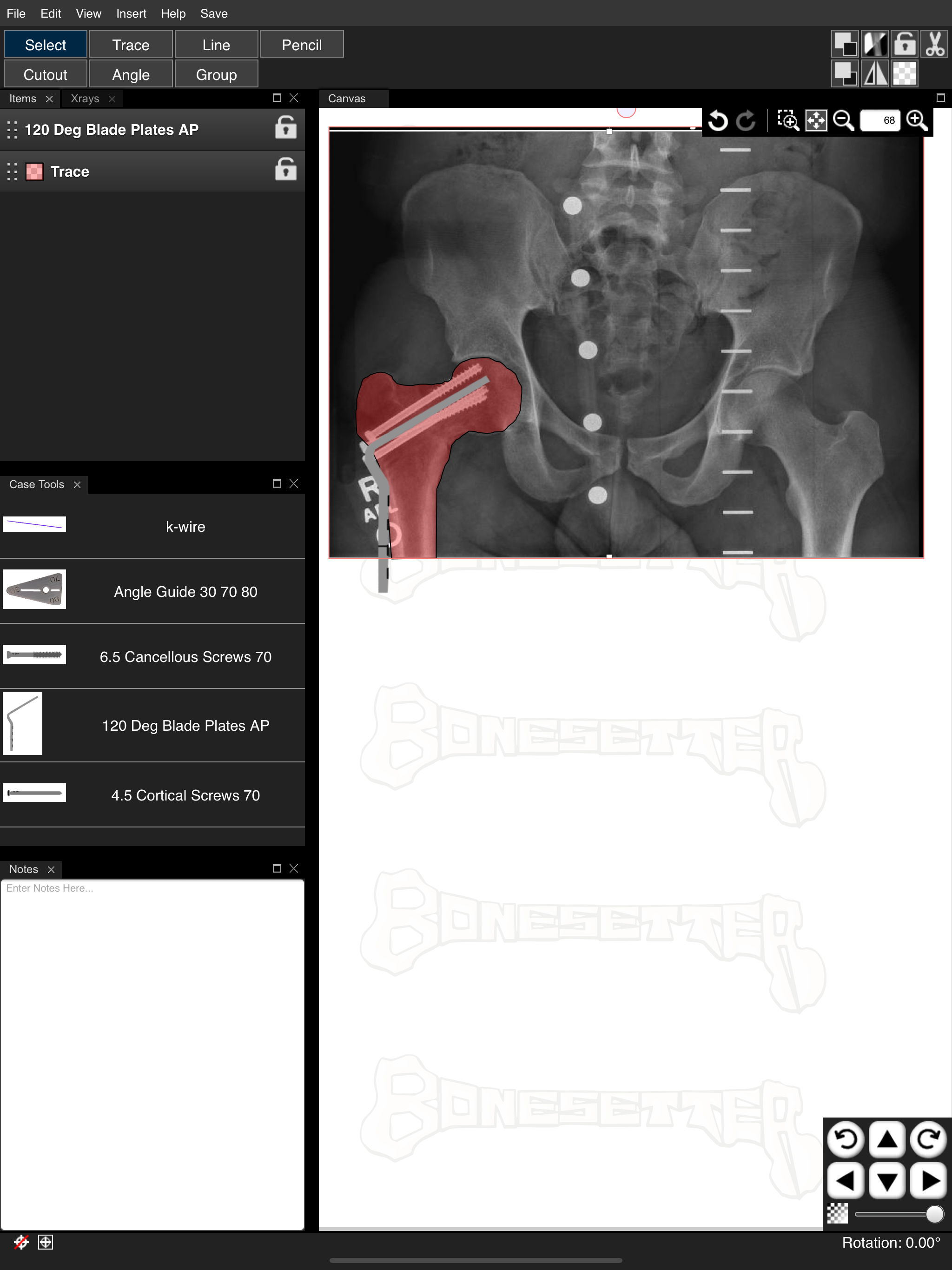 Bonesetter Learning screenshot 5