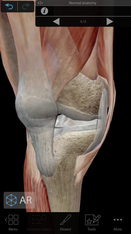 Muscles & Kinesiology screenshot-3