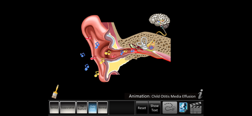 Otitis Media Disorders screenshot 3