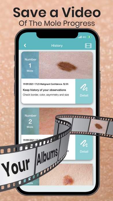 Mole Checker Skin Dermatology Screenshot