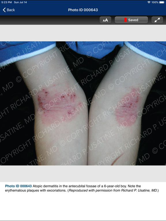 Screenshot #6 pour Usatine Medical Photo Library