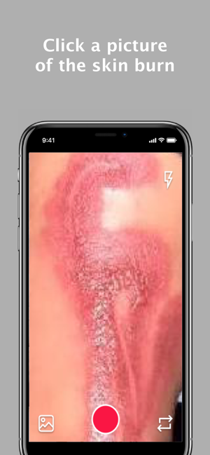 Burn AI(圖1)-速報App