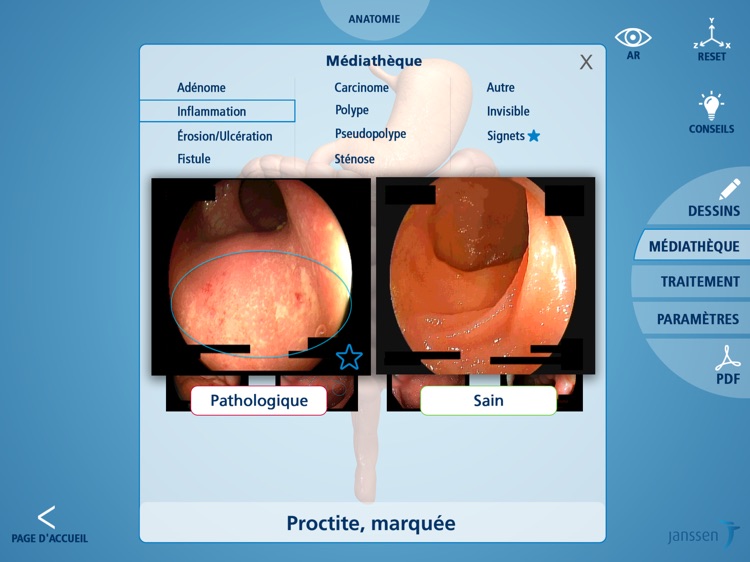 Application MICI screenshot-3