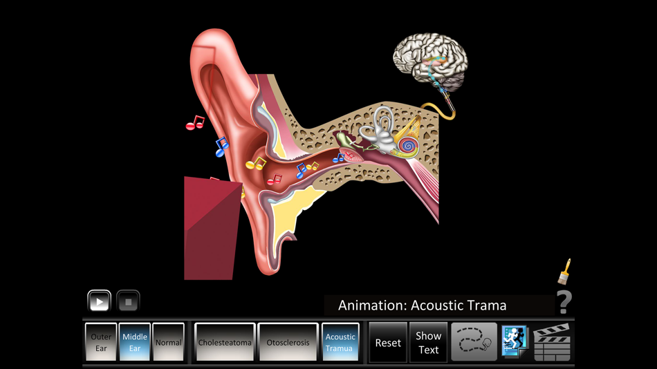 #2. Ear Disorders: Outer Middle (iOS) 由: Blue Tree Publishing, Inc.