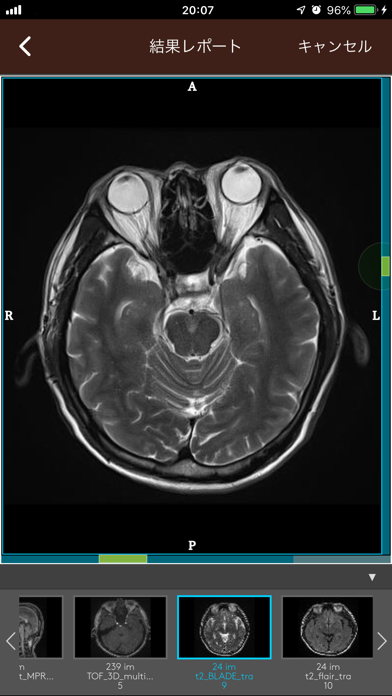 smart HIMEDICのおすすめ画像3