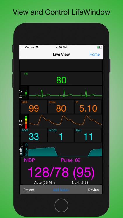 LifeWindow App for iPhone