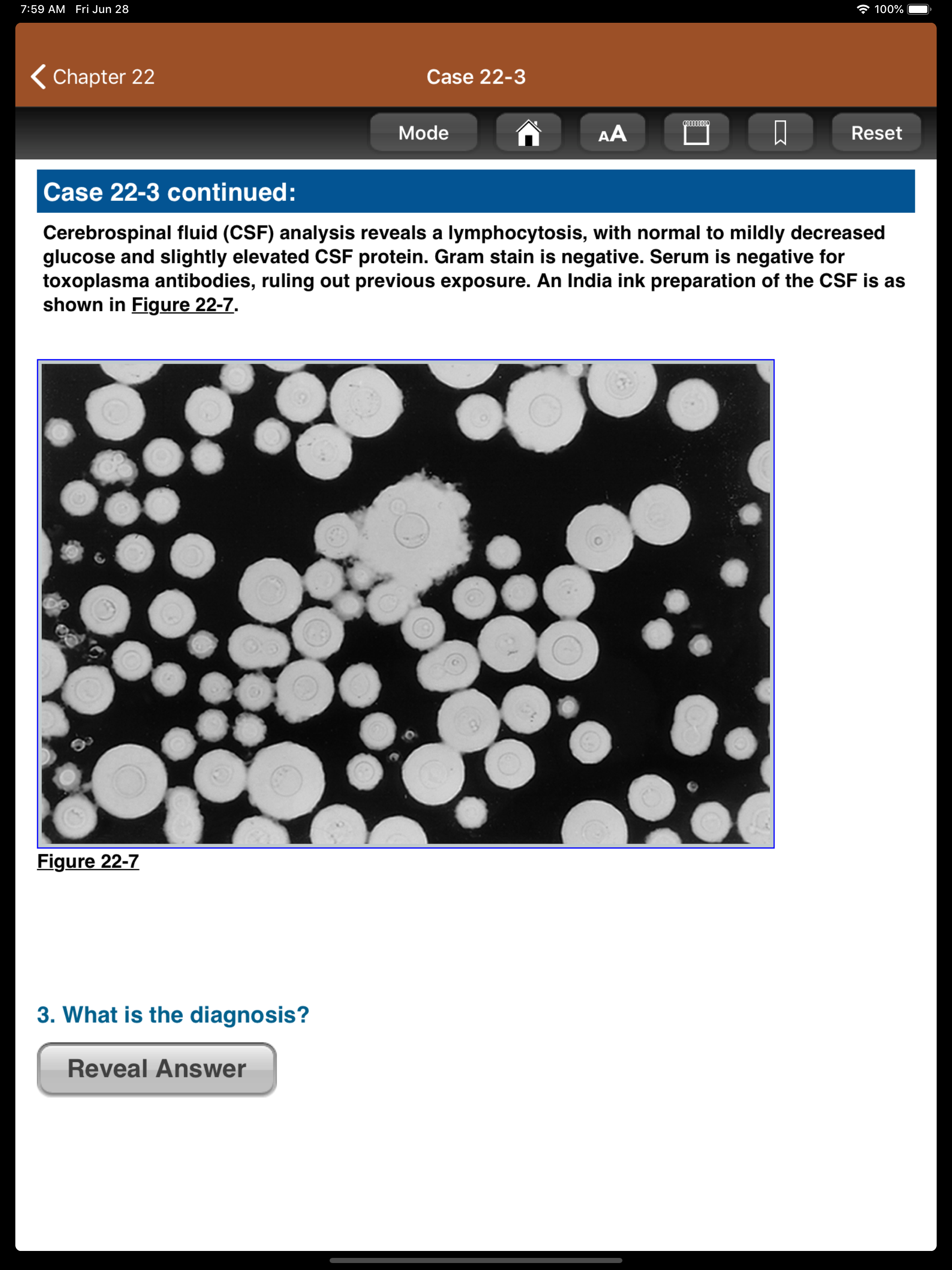 USMLE Step 1 Secrets, 3/E screenshot 9