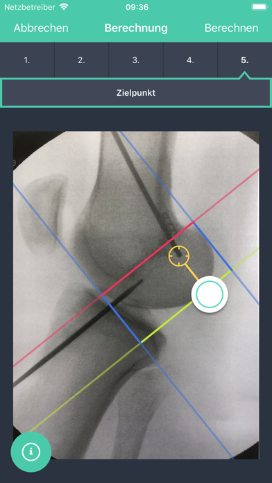 Screenshot #3 pour ACL-X