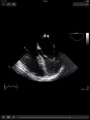 echosource ipad resimleri 3