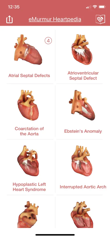 eMurmur Heartpedia