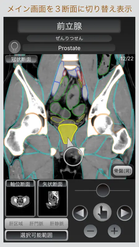 CT Passport 腹部 screenshot 4 of 5