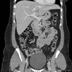 CT Abdomen Pelvis App Support