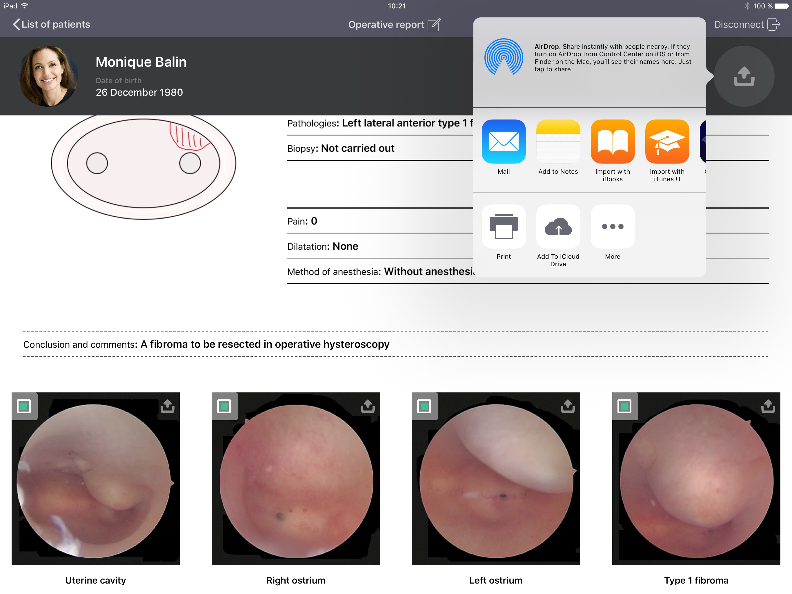 imagyn for iCare screenshot 4