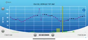 HRV Trace screenshot #1 for iPhone