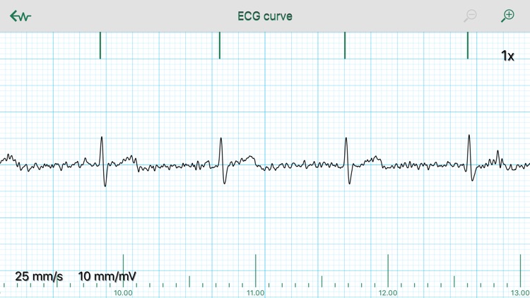 WIWE - ECG diagnostics screenshot-6