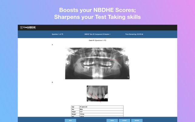Crack NBDHE Dental Hygiene(圖3)-速報App