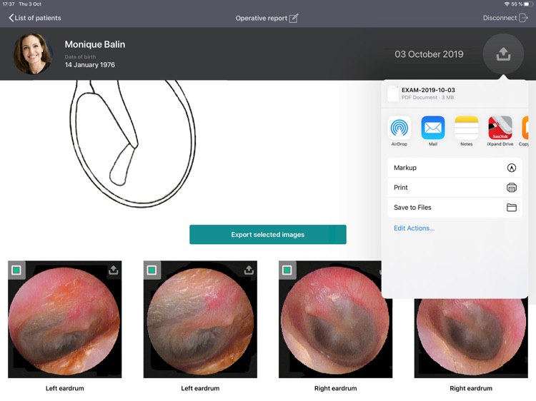MyReport for iCare screenshot-3