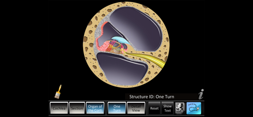 Inner Ear ID screenshot 3