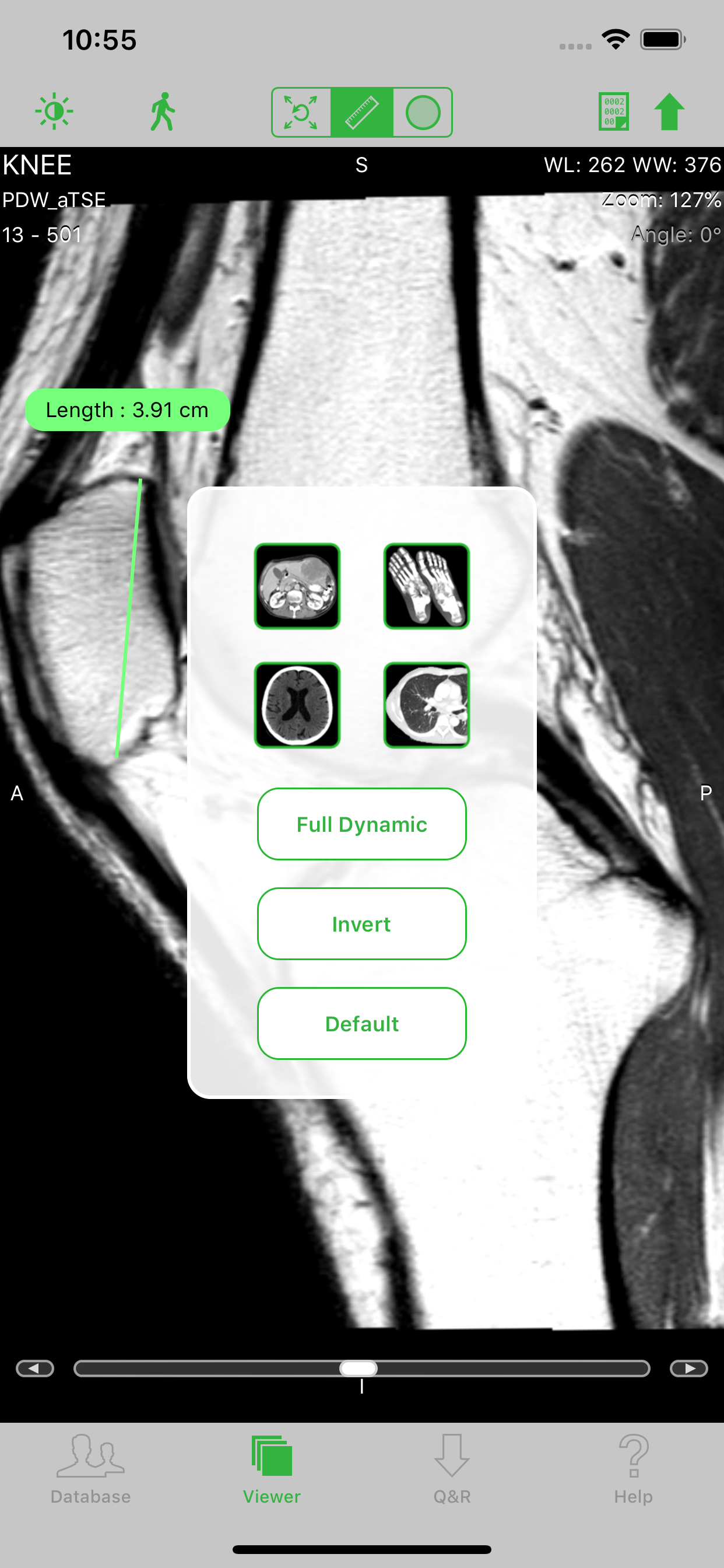 OsiriX HD screenshot 3