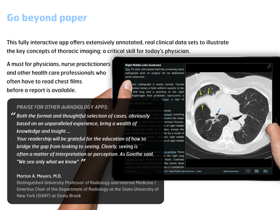 Screenshot #5 pour Radiology - Thoracic Imaging