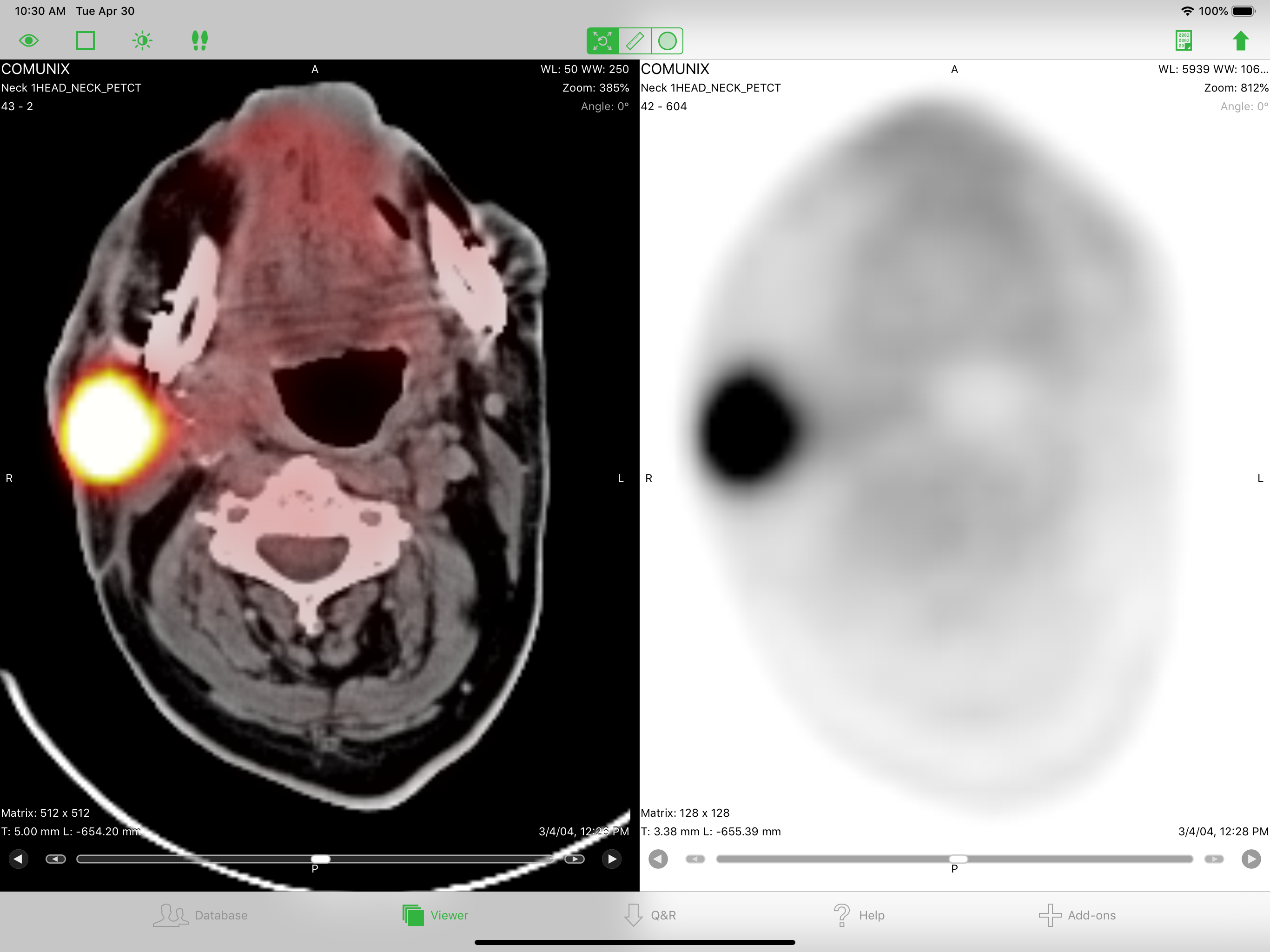 OsiriX HD screenshot 7