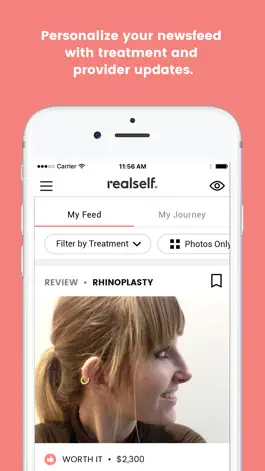 Game screenshot RealSelf: Treatments & Reviews hack
