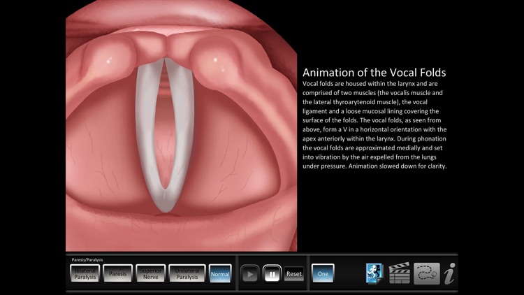 Paresis/Paralysis screenshot-4